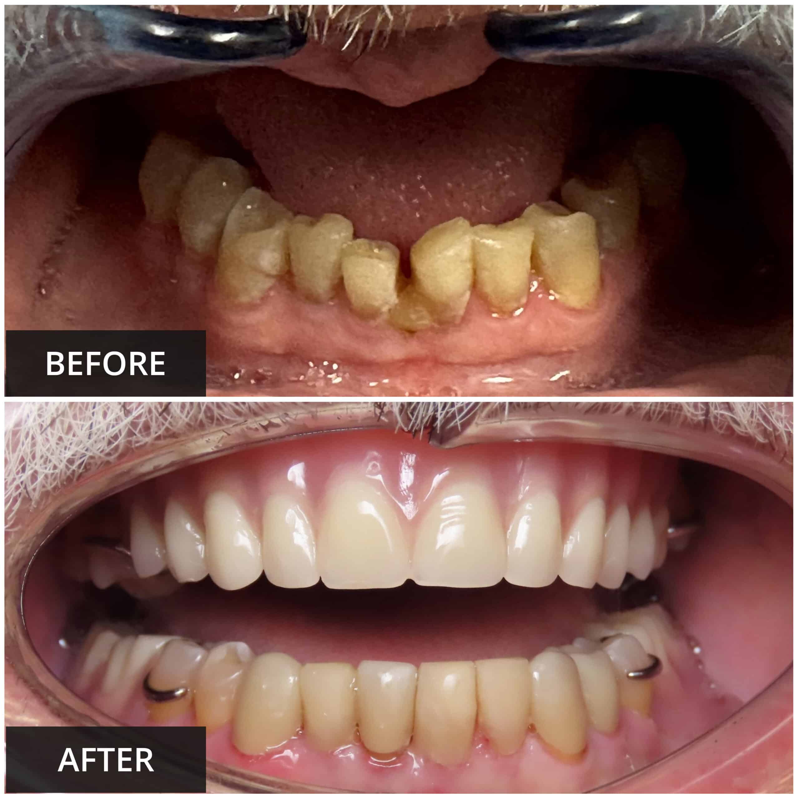 Premier-Dental-Studio-of-Katy-b.a.-image2-scaled
